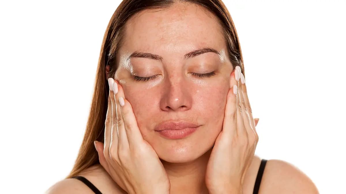 Die Rolle der Ernährung im Kampf gegen Melasma: Tipps für strahlende Haut